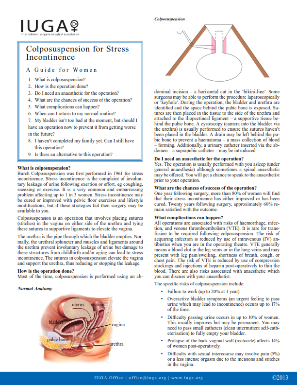 Colposuspension for Stress Incontinence