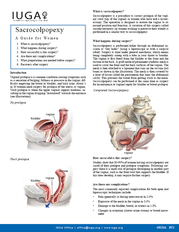 Sacrocolpopexy