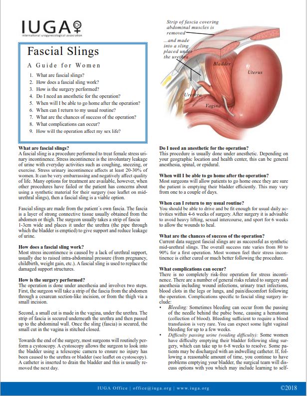 Fascial Slings