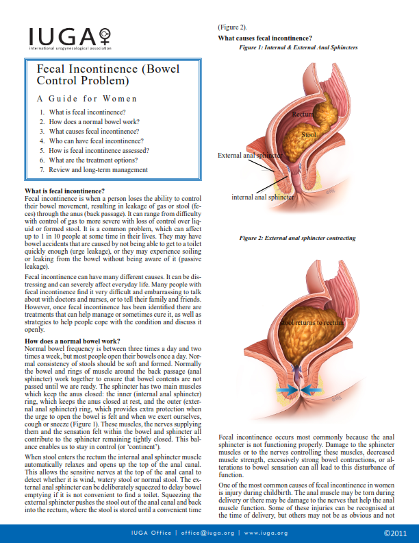 Incontinencia fecal (Problema de control intestinal)
