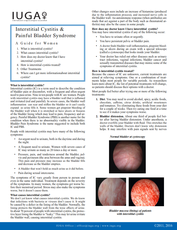 Interstitial Cystitis