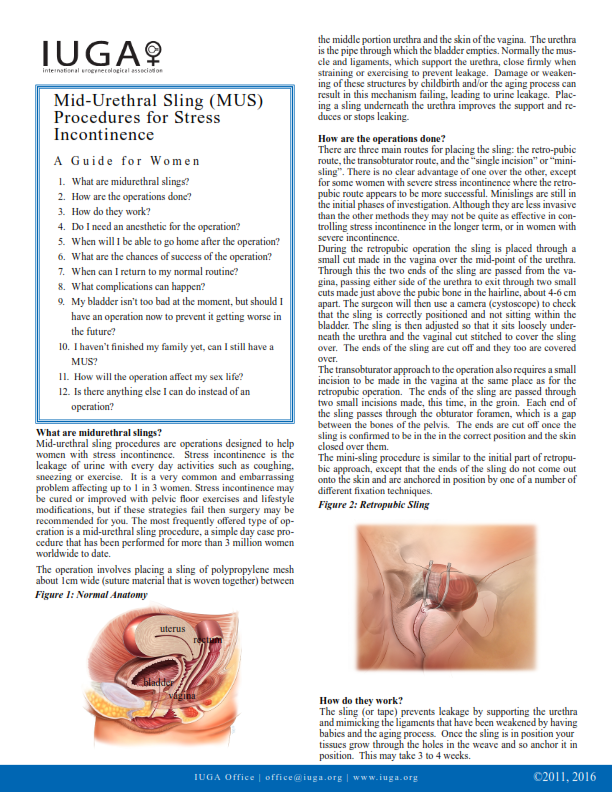 Mid-urethral Sling (MUS) Procedures for Stress Incontinence