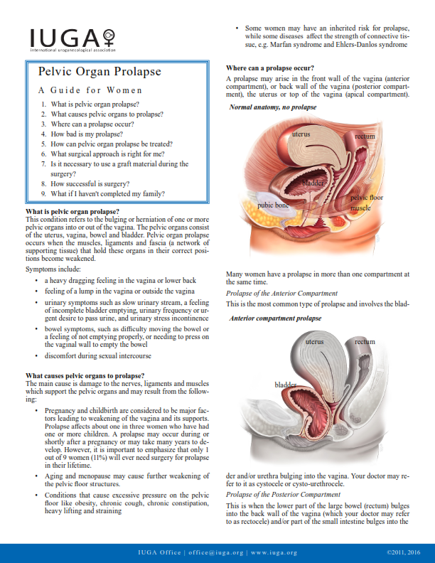 Pelvic Organ Prolapse