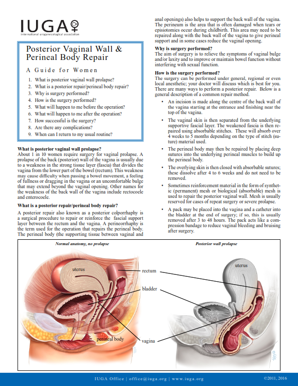 Reparación de la Pared Posterior Vaginal y del Cuerpo Perineal