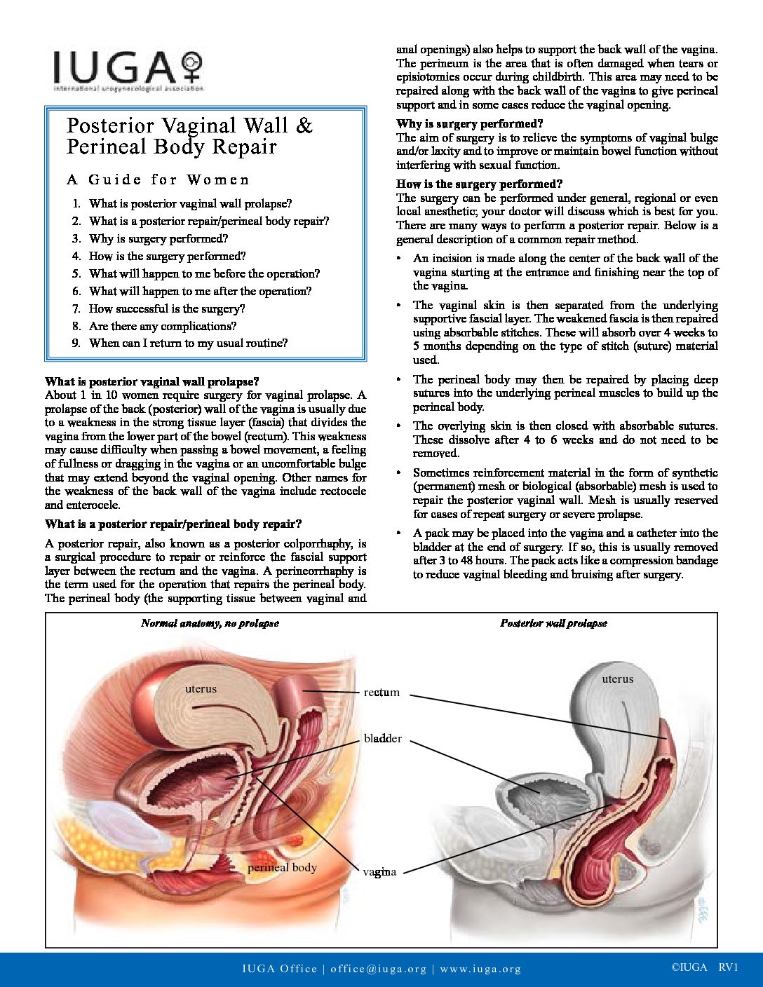 Posterior_Vaginal_Wall_and_Perineal_Body_Repair_RV1 - Your Pelvic Floor
