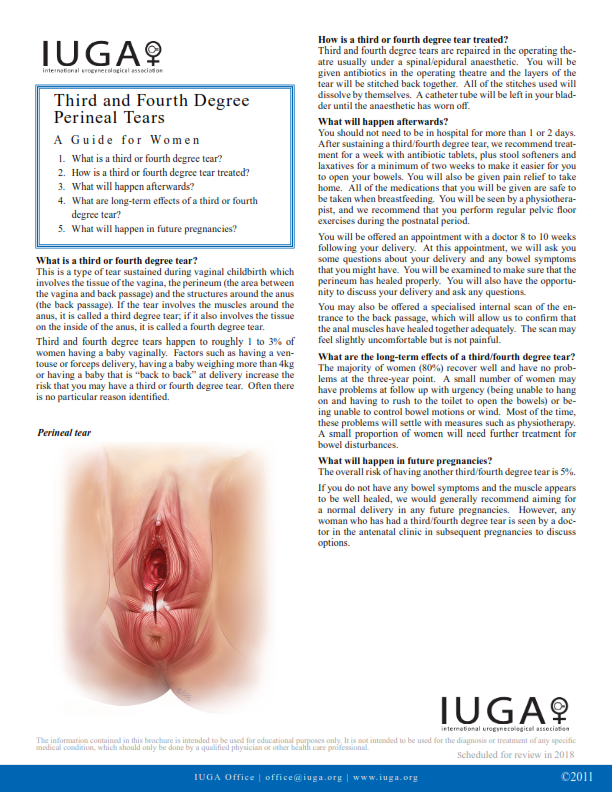 Desgarros perineales de tercer y cuarto grado