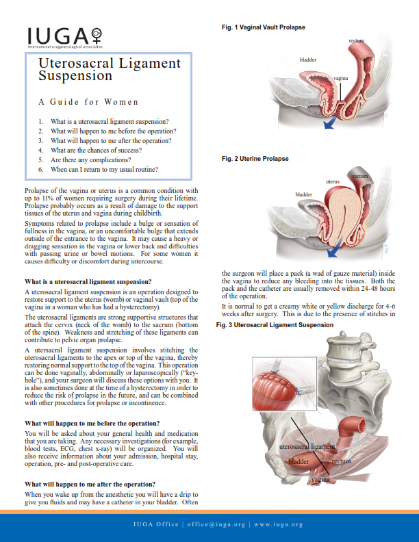 Uterosacral Ligament Suspension