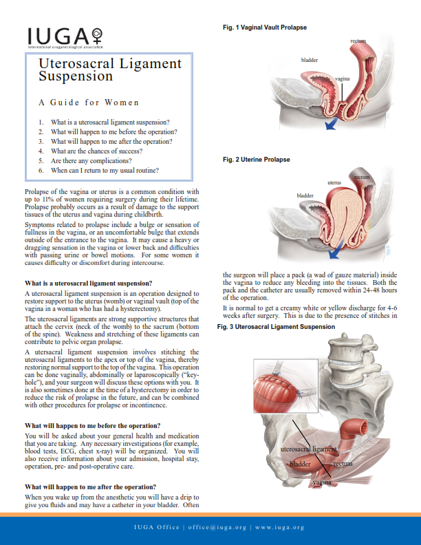 Suspensión Al Ligamento Uterosacro