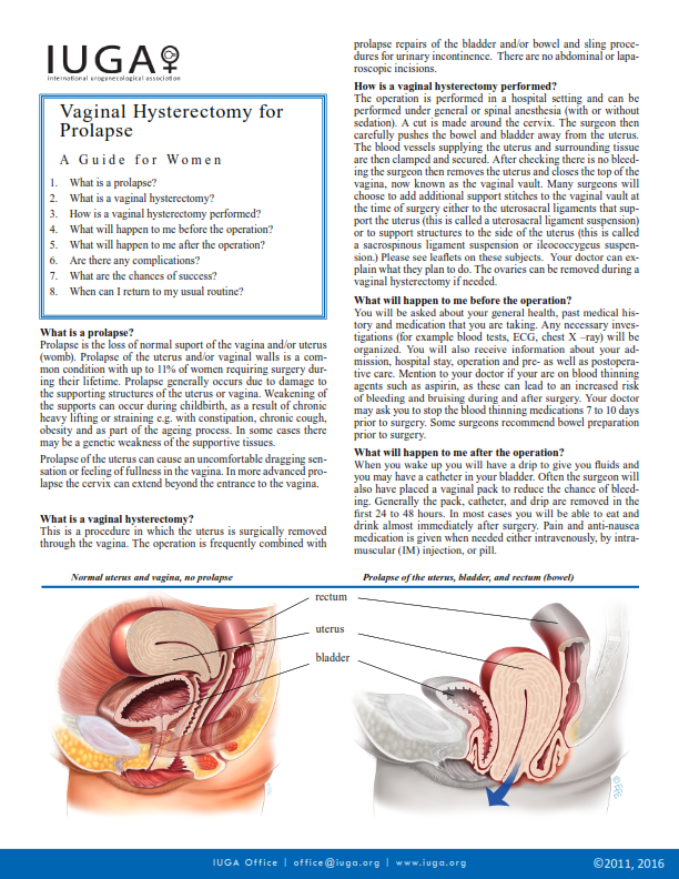 Vaginal Hysterectomy for Prolapse