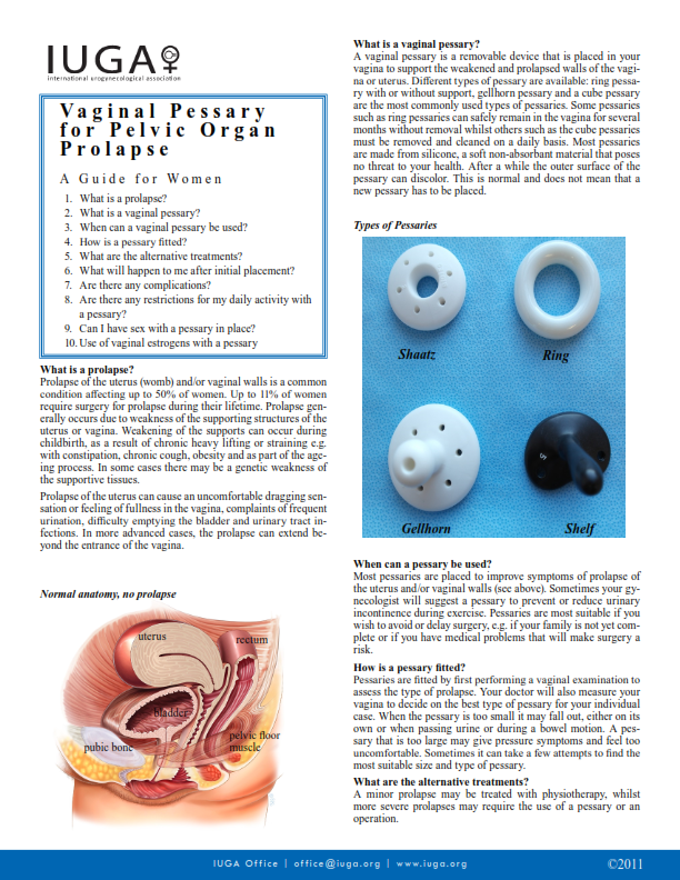 Vaginal Pessary for Pelvic Organ Prolapse